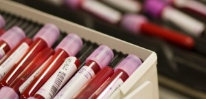 Blood samples are pictured at the Swiss Laboratory for Doping Analysis in Epalinges near Lausanne.